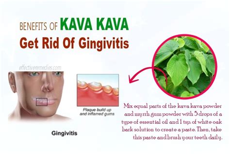 14 Beauty & Health Benefits Of Kava Kava - Uses & Side Effects