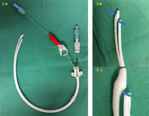 Non Tunneled Central Venous Catheter