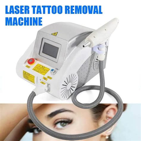 Details 96+ about different types of laser tattoo removal super cool ...