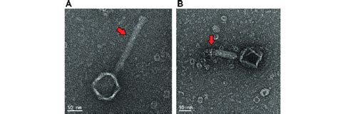 Transmission electron micrographs of Cronobacter sakazakii phage Φ... | Download Scientific Diagram