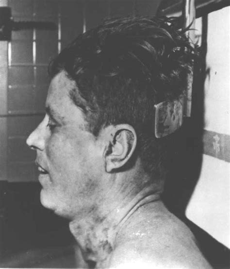 John F. Kennedy autopsy photo (#4) - Weird Picture Archive