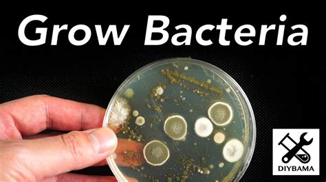 Petri Dish Bacteria Growth