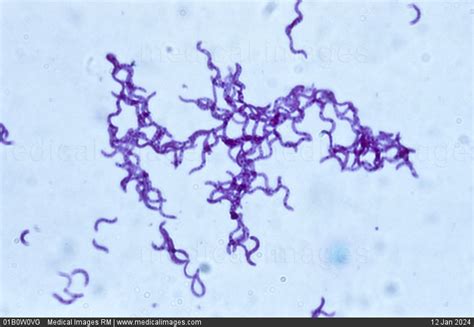 STOCK IMAGE, photomicrograph of spirillum spiral bacteria mag 400x at 24 x 36 mm, 3860, 01B0W0VG ...