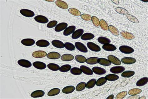 Fungal Spores Under Microscope