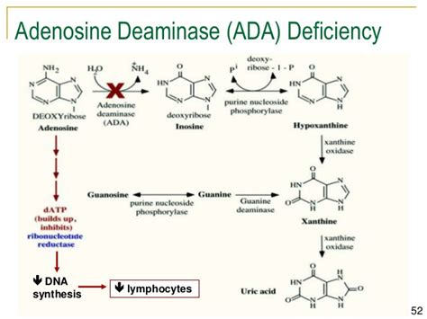 Adenosine Deaminase (ADA)