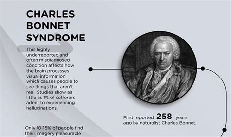 Charles Bonnet syndrome #infographic - Visualistan