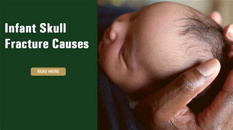 Infant Skull Fracture Causes | Medical Malpractice | Raynes Lawn