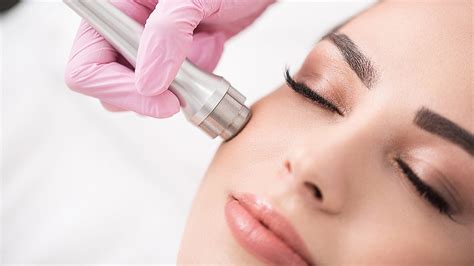 Microdermabrasion Facial - VS MedSpa Skin Clinic in Toronto