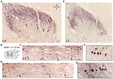 | Calbindin-immunopositive neuronal distribution in the frontal (A) and ...