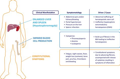 Myelofibrosis