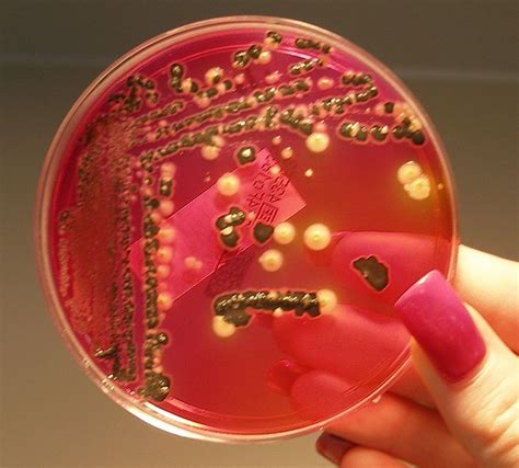 Salmonella On Xld Agar Plate Pics For Xld Agar Microbiology Medical | Images and Photos finder