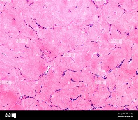 Corpus albicans, light micrograph Stock Photo - Alamy