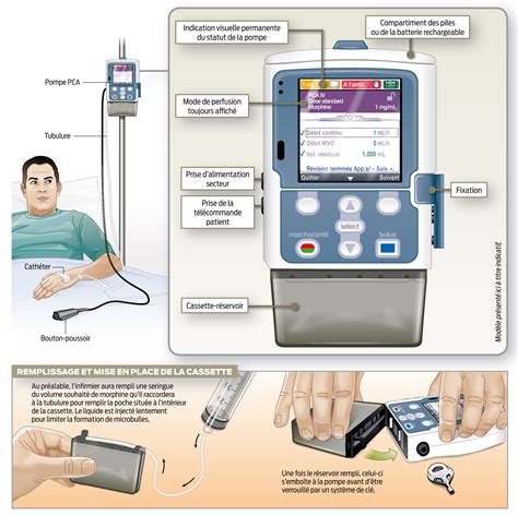 La pompe PCA de morphine | Le Pharmacien de France - Magazine