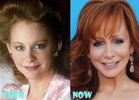 Reba McEntire Plastic Surgery Before After Pictures - Lovely Surgery | Celebrity Before and ...