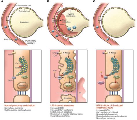 JCI - Calcium flux and endothelial dysfunction during acute lung injury: a STIMulating target ...