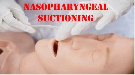 Nasopharyngeal Suctioning - NMC OSCE Skill Station - OSCE Trainer