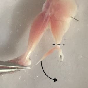 Dissection of mouse EDL and Soleus muscles