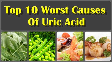 What Causes High Uric Acid Levels in The Body? And Get Rid Of Uric Acid Crystals Fast - YouTube