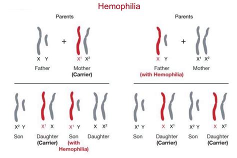 Sex-Linked Traits and Disorders