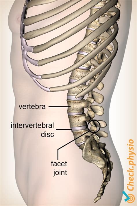 Lumbar facet syndrome | Physio Check