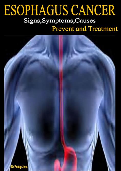 esophagus cancer symptoms in tamil Esophagus cancer signs , symptoms, causes , prevent and treatment