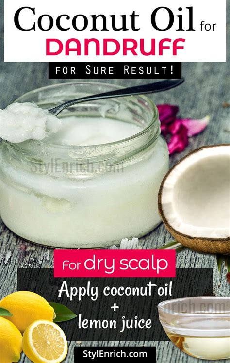 How to Remove Dandruff using Coconut Oil | Treating Dry Scalp Dandruff