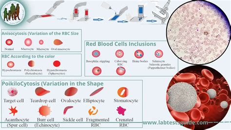 Peripheral Blood Smear Test Purpose, Procedure, Result and many more