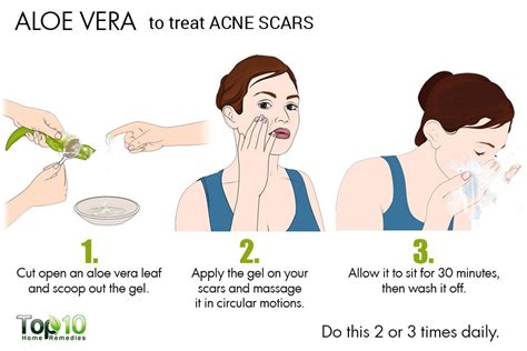 How to Get Rid of Acne Scars | Top 10 Home Remedies