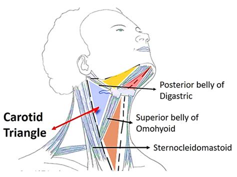 Carotid Triangle , Boundaries and Contents , Anatomy QA