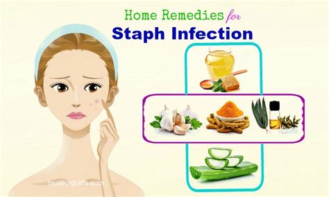 14 Home Remedies for Staph Infection Pain on Face, Scalp, Buttocks ...