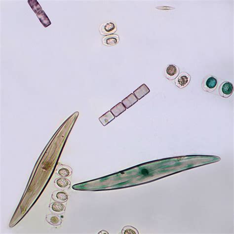 Diatoms Under Microscope