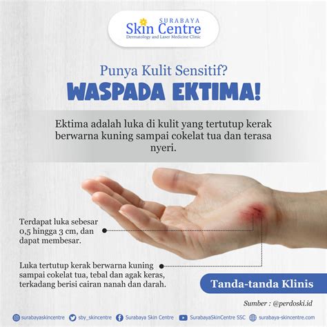 Surabaya Skin Centre | Blog Details