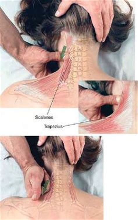 20 Pinched nerve ideas | pinched nerve, nerve, massage therapy