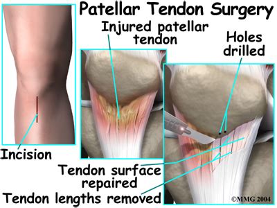 Patient Education | Concord Orthopaedics