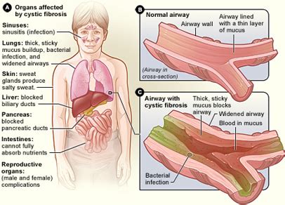 Mucous Membrane | Location, Function & Examples - Lesson | Study.com