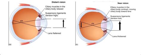 6): Focus and accommodation by the eye,(a): The lens is flattened and ...