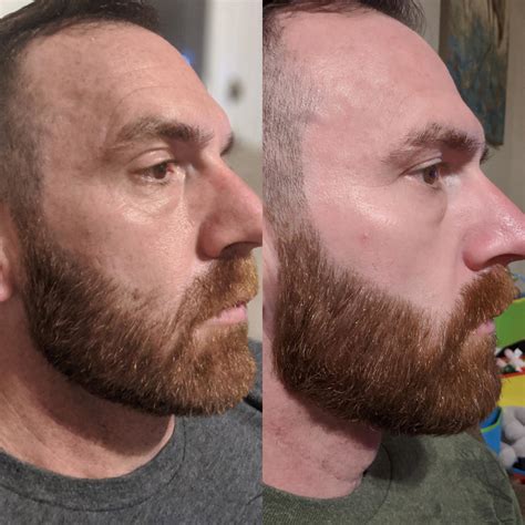 1 month progress from a bad beard trim : r/beards