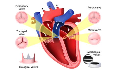 Heart Disease: Important Signs, Symptoms and Types of Heart Problems | Medanta