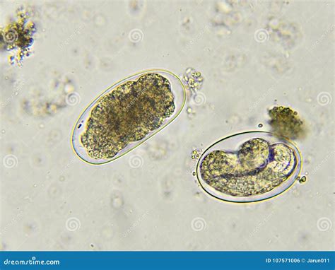 Eggs of Hookworm in stool stock photo. Image of microscope - 107571006