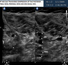 19 Ultrasound ideas | ultrasound, diagnostic medical sonography, sonography