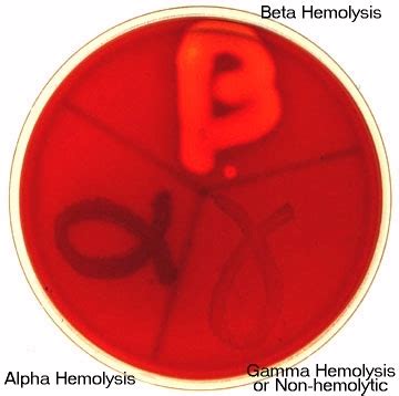 Hemolysis - Microbiology - Medbullets Step 1