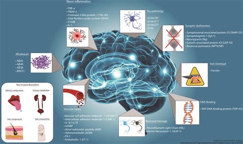 Biomarkers and Their Implications in Alzheimer’s Disease: A Literature Review