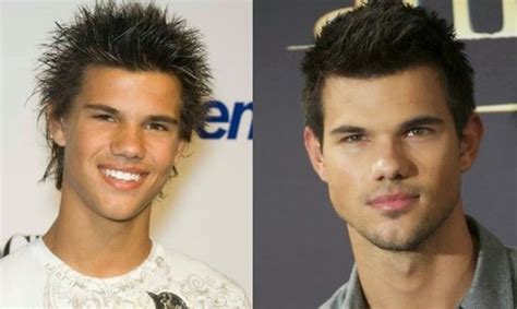 Taylor Lautner Nose Job