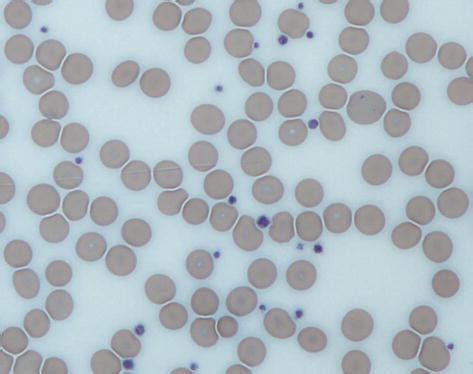 Platelets Microscope