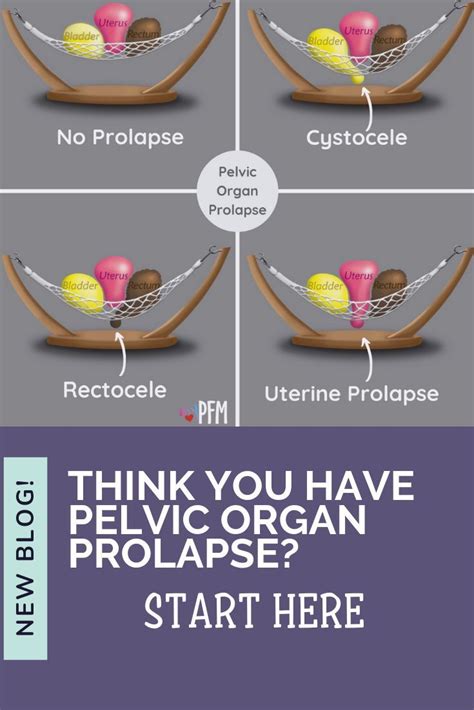 Think You Have Pelvic Organ Prolapse? | Uterine prolapse, Pelvic organ prolapse, Pelvic floor ...