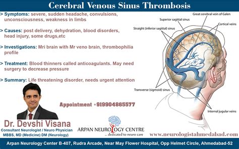 Pin on Neurologist in Ahmedabad