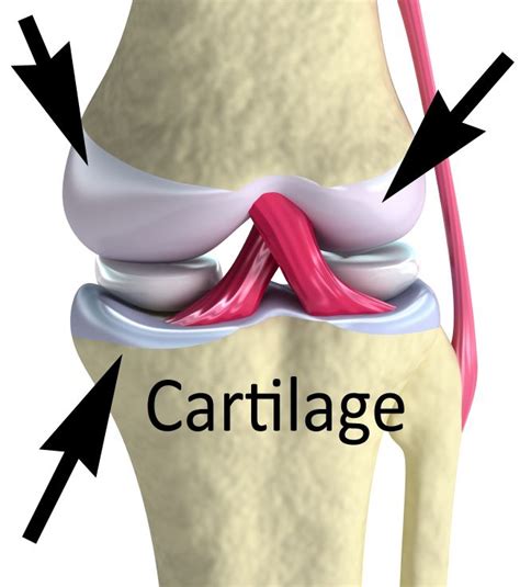 Difference Between Cartilage, Ligaments and Tendons | Bohatala.com | Ligaments and tendons ...