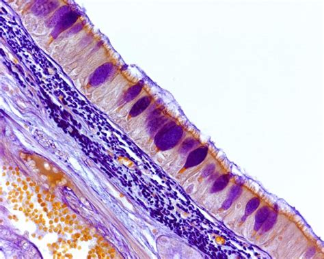 Small-Molecule Ion Channels Restore Host Defenses in CF Airway ...