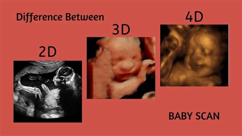 PPT - Difference Between 2D, 3D, And 4D Ultrasound Baby Scan PowerPoint ...