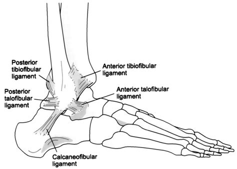 High Ankle Sprains - Yakima Foot & Ankle